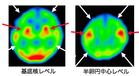 NMC Diagnosis