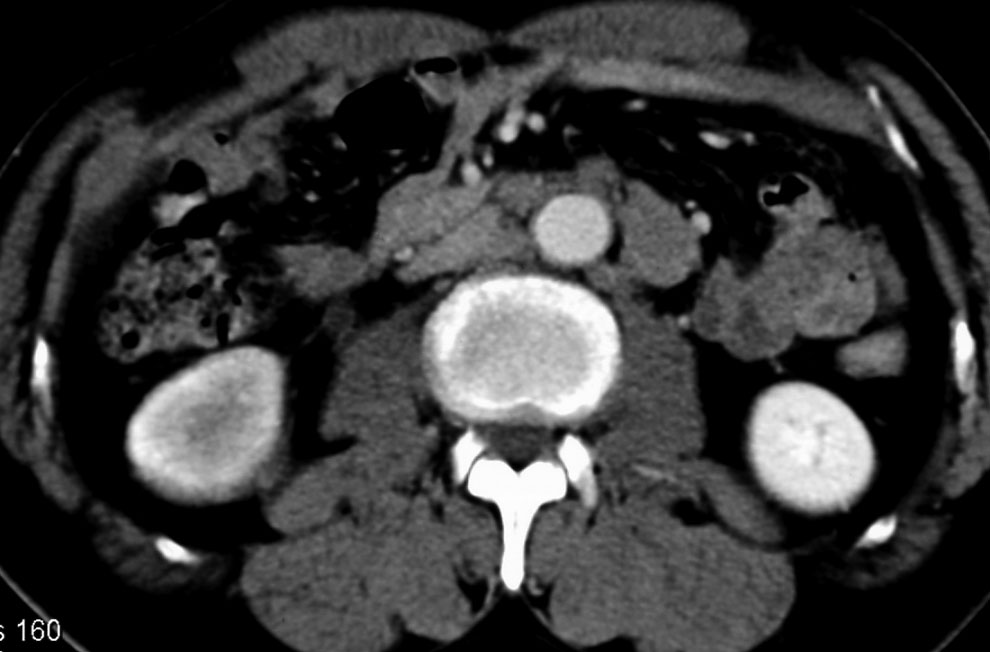 Nuclear Medicine Imaging Conference